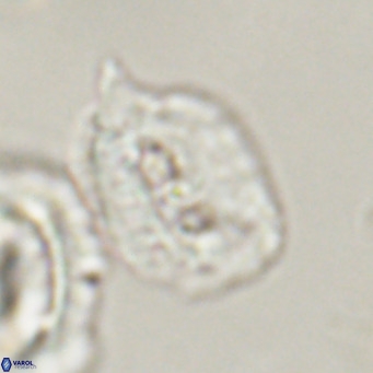 Helicosphaerella recta VR 32756