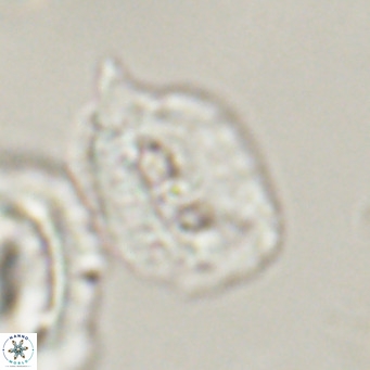 Helicosphaerella recta VR 32756