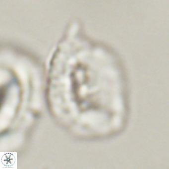 Helicosphaerella recta VR 32757