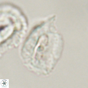 Helicosphaerella recta VR 32758