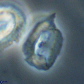 Helicosphaerella recta VR 32759