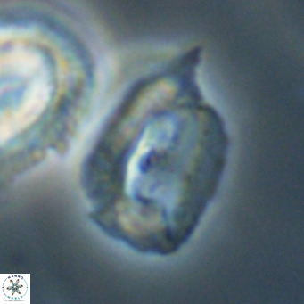 Helicosphaerella recta VR 32759