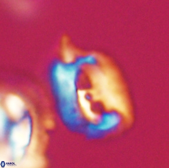 Helicosphaerella recta VR 32750