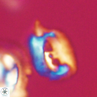 Helicosphaerella recta VR 32750