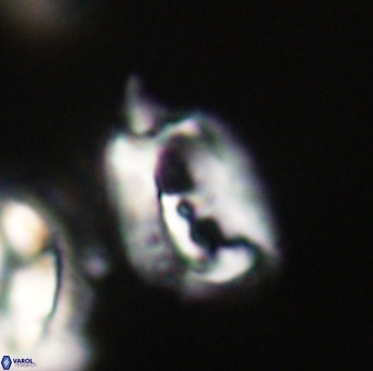Helicosphaerella recta VR 32751