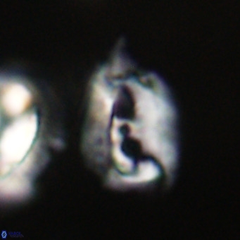 Helicosphaerella recta VR 32752