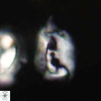 Helicosphaerella recta VR 32752