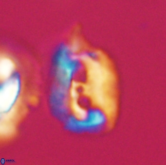 Helicosphaerella recta VR 32753