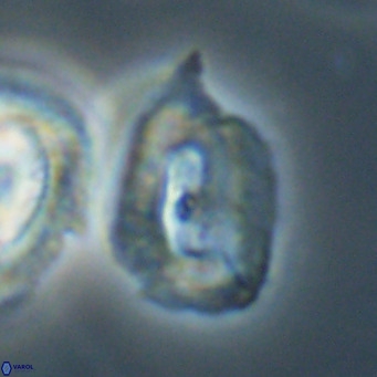 Helicosphaerella recta VR 32760