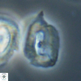 Helicosphaerella recta VR 32760