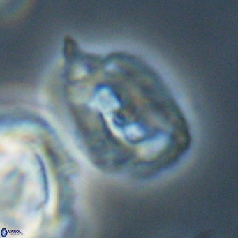 Helicosphaerella recta VR 32761