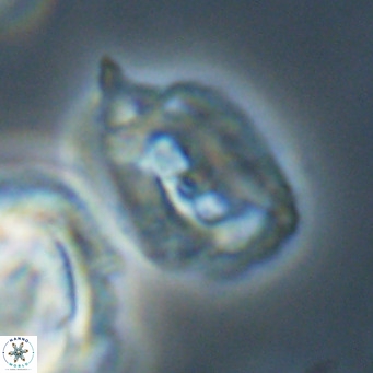 Helicosphaerella recta VR 32761