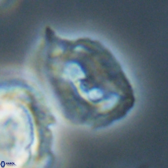 Helicosphaerella recta VR 32762