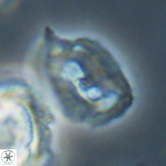 Helicosphaerella recta VR 32762
