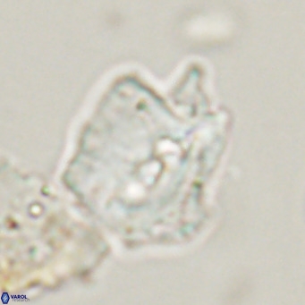 Helicosphaerella robinsoniae VR 33118