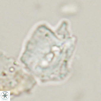 Helicosphaerella robinsoniae VR 33118