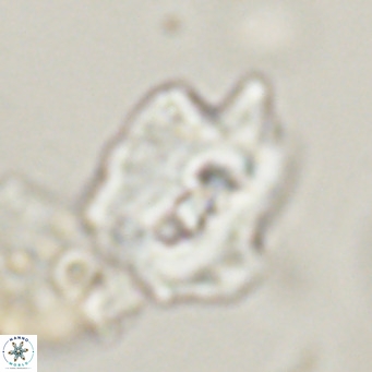 Helicosphaerella robinsoniae VR 33119
