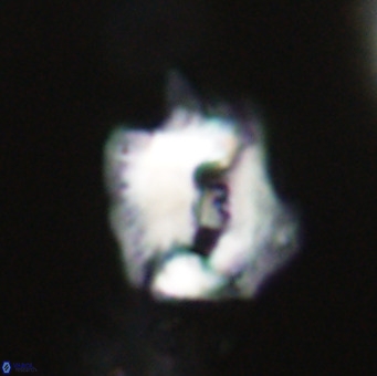 Helicosphaerella robinsoniae VR 33112