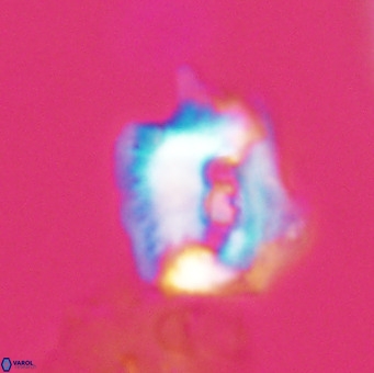 Helicosphaerella robinsoniae VR 33113