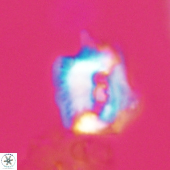 Helicosphaerella robinsoniae VR 33113