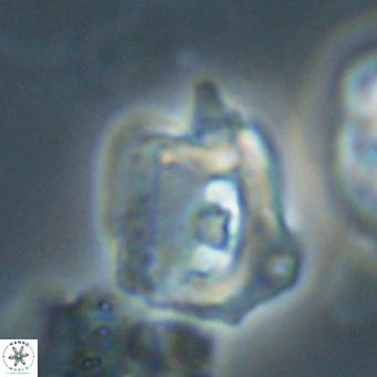 Helicosphaerella robinsoniae VR 33124