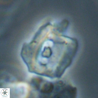 Helicosphaerella robinsoniae VR 33126
