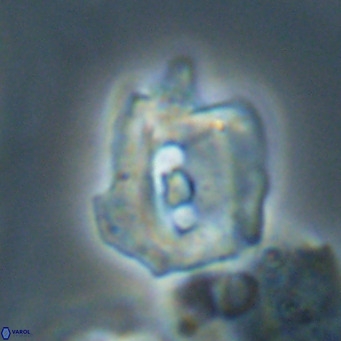 Helicosphaerella robinsoniae VR 33127