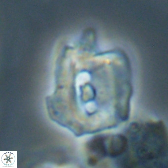 Helicosphaerella robinsoniae VR 33127