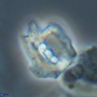 Helicosphaerella robinsoniae VR 33128