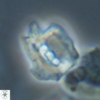 Helicosphaerella robinsoniae VR 33128