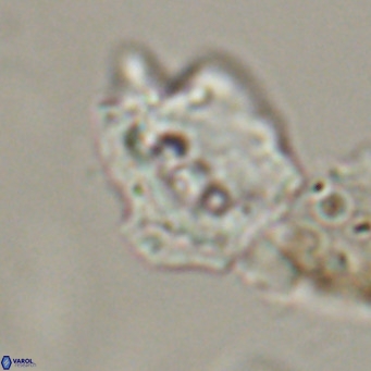 Helicosphaerella robinsoniae VR 33129