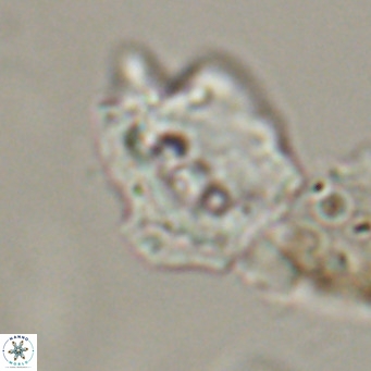Helicosphaerella robinsoniae VR 33129