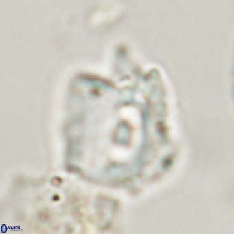 Helicosphaerella robinsoniae VR 33120