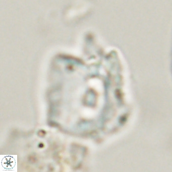 Helicosphaerella robinsoniae VR 33120