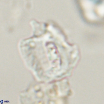 Helicosphaerella robinsoniae VR 33122