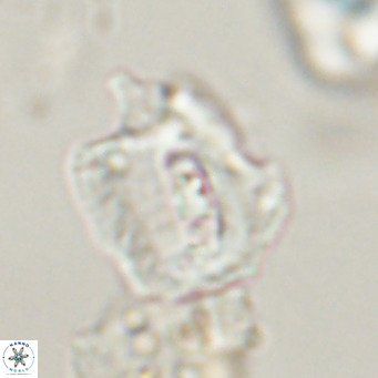 Helicosphaerella robinsoniae VR 33122