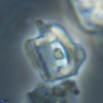 Helicosphaerella robinsoniae VR 33123