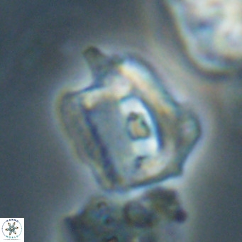 Helicosphaerella robinsoniae VR 33123