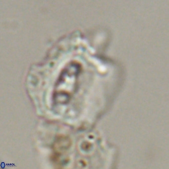 Helicosphaerella robinsoniae VR 33134