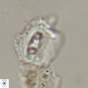 Helicosphaerella robinsoniae VR 33134