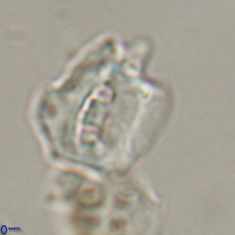 Helicosphaerella robinsoniae VR 33135