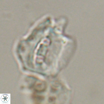 Helicosphaerella robinsoniae VR 33135