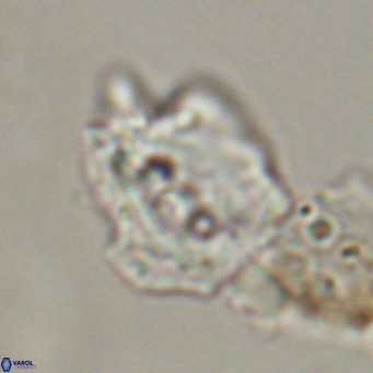 Helicosphaerella robinsoniae VR 33130