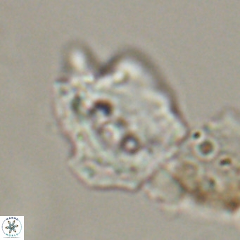Helicosphaerella robinsoniae VR 33130
