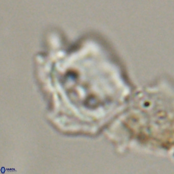 Helicosphaerella robinsoniae VR 33131