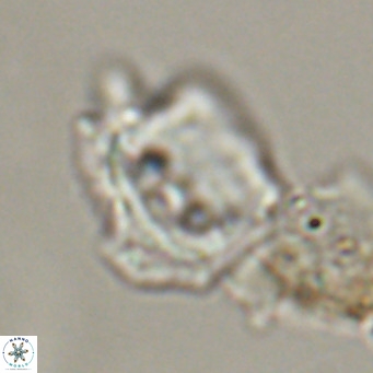Helicosphaerella robinsoniae VR 33131