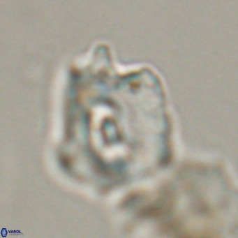 Helicosphaerella robinsoniae VR 33132