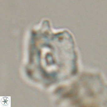 Helicosphaerella robinsoniae VR 33132