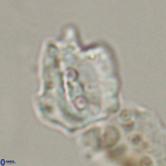 Helicosphaerella robinsoniae VR 33133