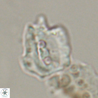 Helicosphaerella robinsoniae VR 33133